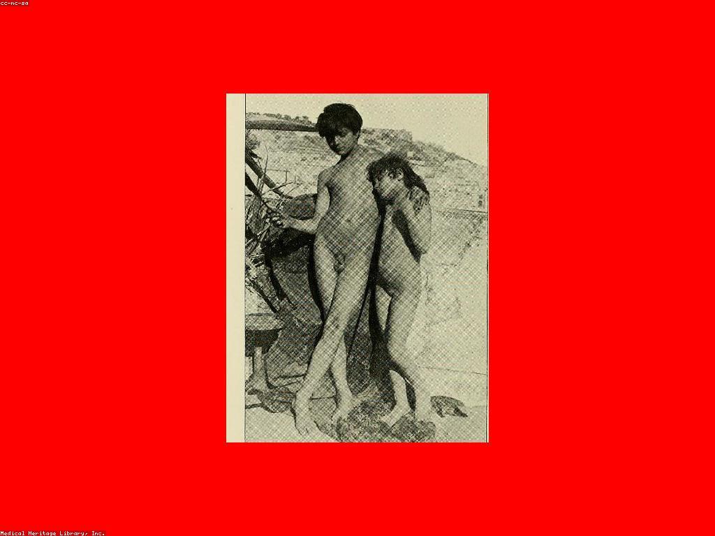 យុទ្ធសាស្ត្រសំរាប់ការអភិវឌ្ឍផ្ទាល់ខ្លួន